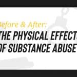 Before & After: Physical Effects of Drugs